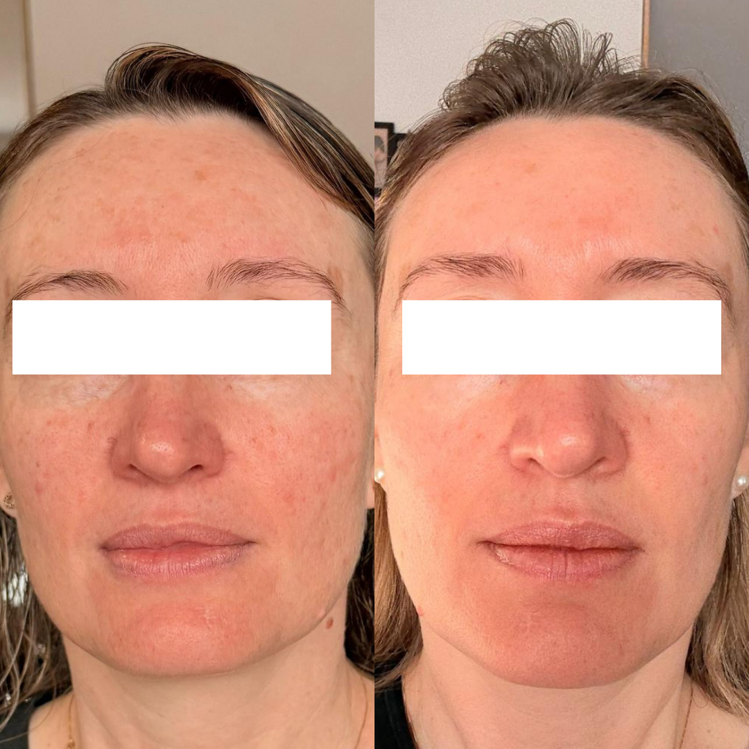 Resultado 7 de acompanhamento personalizado de skincare