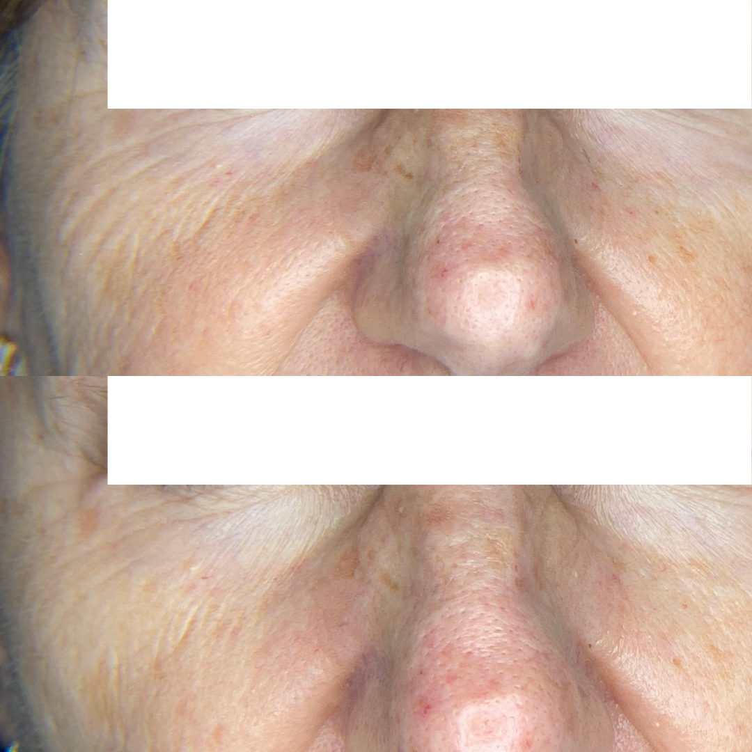 Resultado 9 de acompanhamento personalizado de skincare