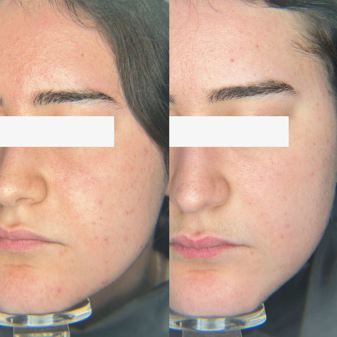 Resultado 8 de acompanhamento personalizado de skincare